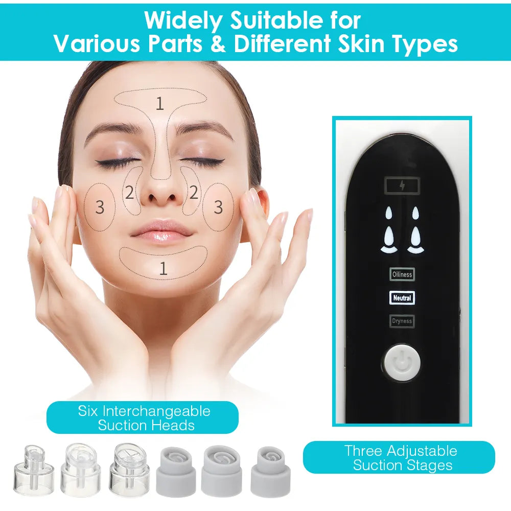 Blackhead Removal Pore Vacuum